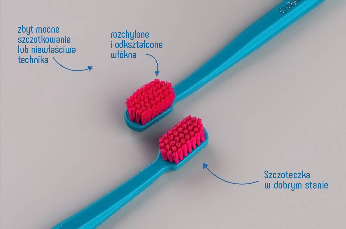 Porównanie szczoteczki do zębów w dobrym stanie i zużytej – rozchylone włókna przez zbyt mocne szczotkowanie