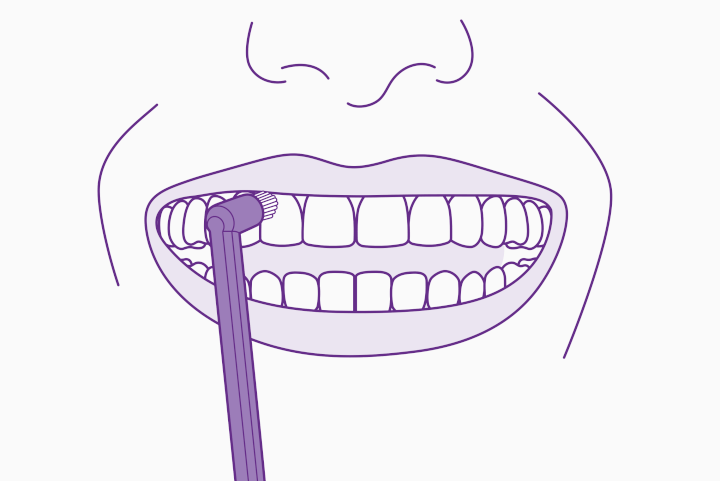 czyszczenie zębów metodą 'solo' czyli ząb po zębie